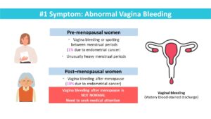 Understanding Uterine Cancer And Its Treatment - 365 Cancer Prevention ...