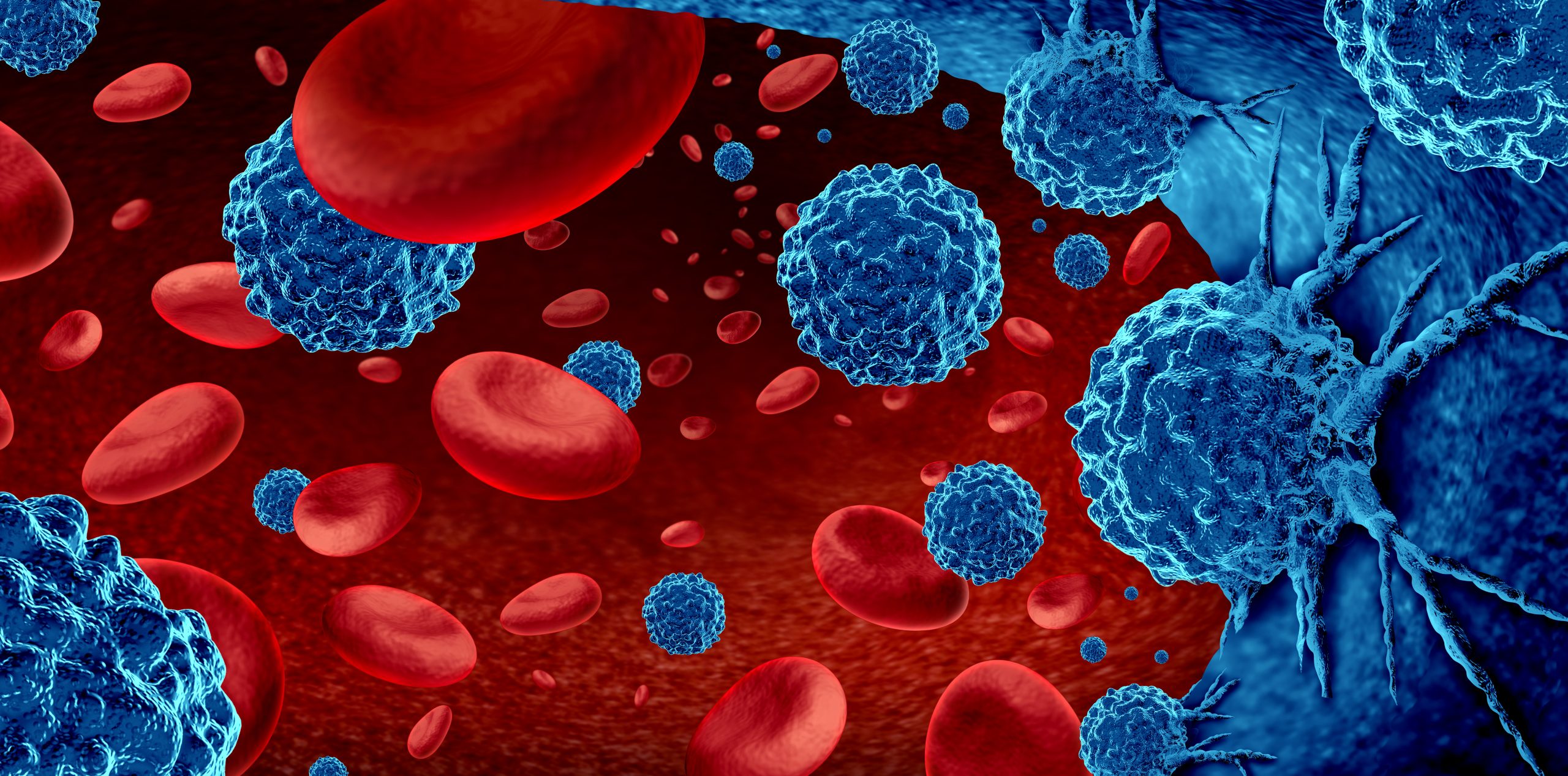 Three Things You Need to Know About CAR T-cell Therapy