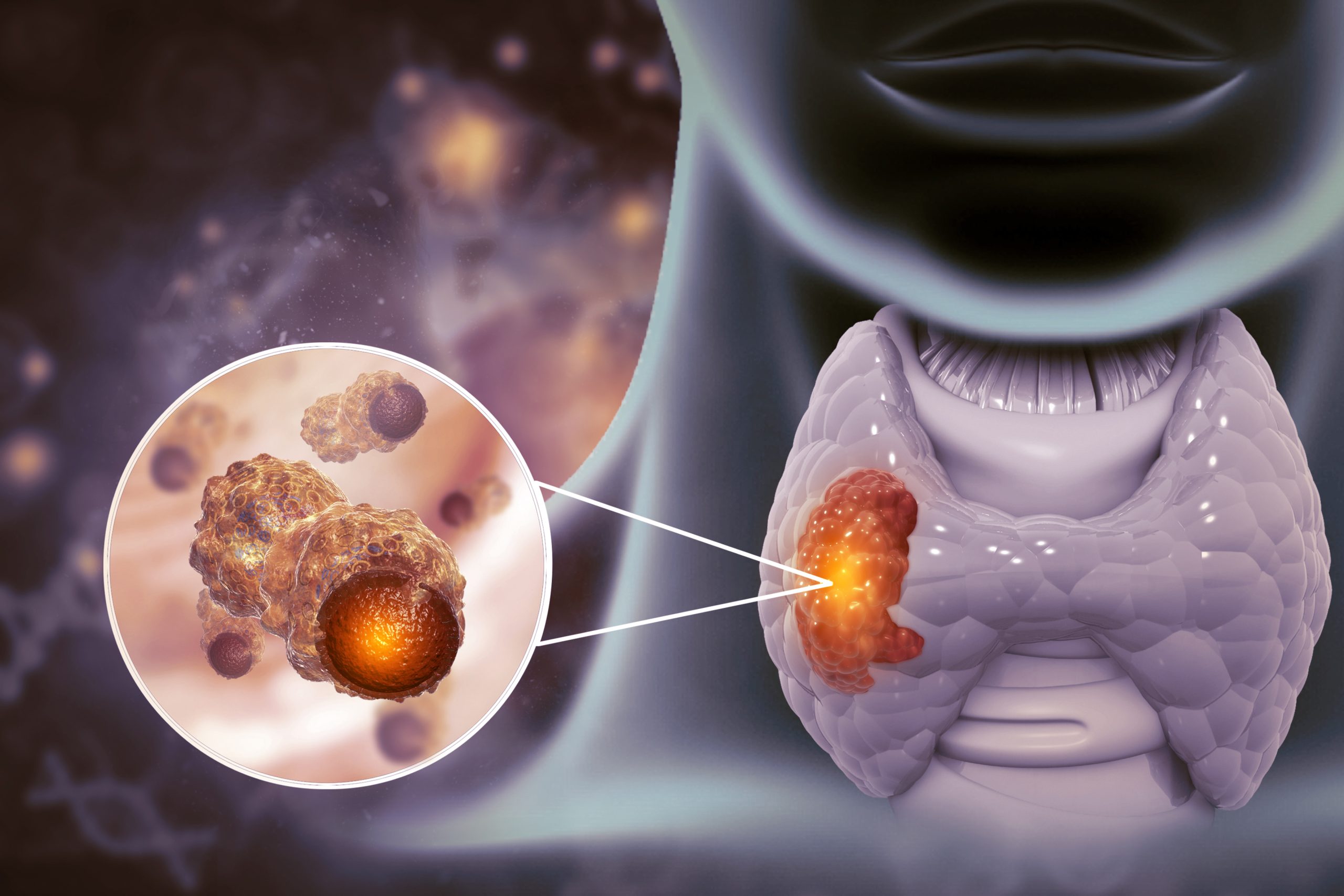 What Do We Need to Know About Thyroid Cancer?